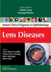 Lens Diseases