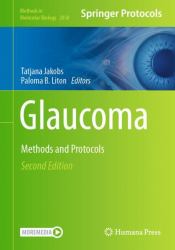 Glaucoma : Methods and Protocols