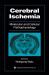 Cerebral Ischemia