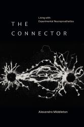 The Connector : Living with Experimental Neuroprosthetics