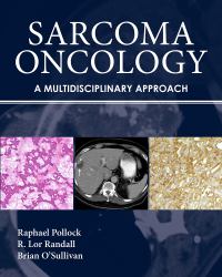 Sarcoma Oncology : A Multidisciplinary Approach