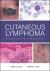 Cutaneous Lymphoma : Diagnosis and Treatment