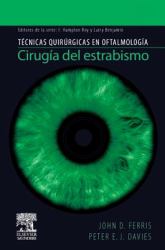 Cirugia del estrabismo