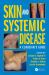 Skin and Systemic Disease : A Clinician's Guide