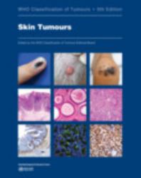 Skin Tumours : WHO Classification of Tumours