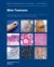 Skin Tumours : WHO Classification of Tumours