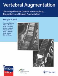 Vertebral Augmentation : The Comprehensive Guide to Vertebroplasty, Kyphoplasty, and Implant Augmentation