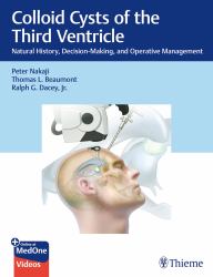 Colloid Cysts of the Third Ventricle : Natural History, Decision-Making, and Operative Management