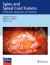 Spine and Spinal Cord Tumors : Classification, Management and Treatment