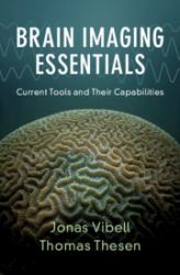 Brain Imaging Essentials : Current Tools and Their Capabilities