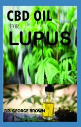 CBD Oil for Lupus : All You Need to Know on How Cbd Oil Treats and Cures Lupus